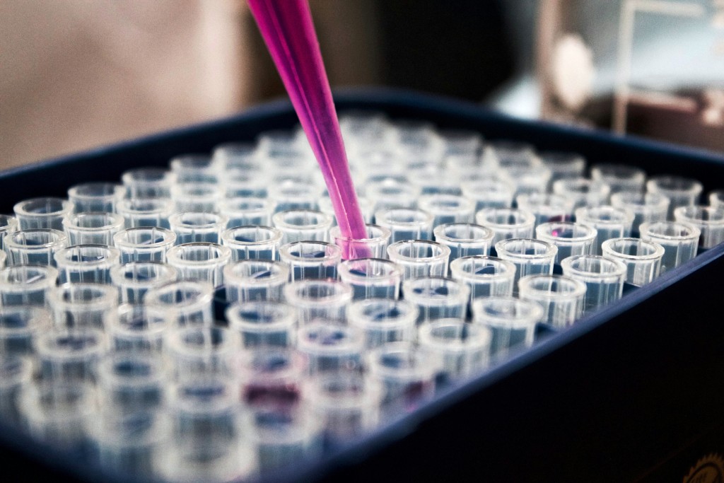 Glass tubes being filled with testing solutions to assist in determining the proper course of treatment for a patient's customized treatment program.
